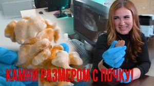 МОЧЕКАМЕННАЯ БОЛЕЗНЬ НЕ ПРИГОВОР!