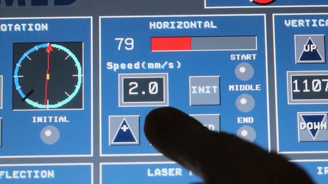 Ureterorenoscopia con Avicenna Roboflex. Orlando 2014 смотреть онлайн