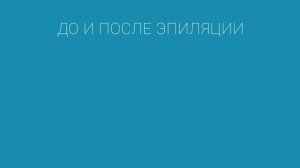 Лазерная эпиляция кистей рук александритовым лазером! Клиника АГГЕР. Астрахань.