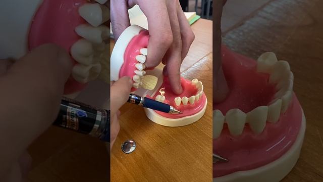 Ментальная анестезия Жулдигали Е.