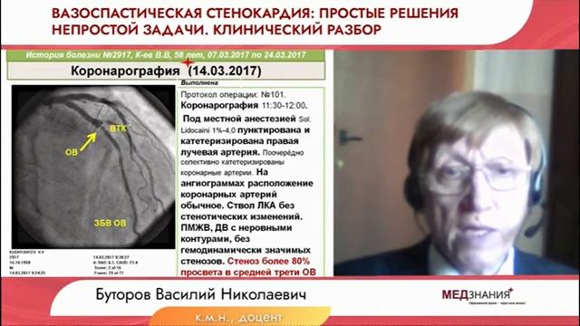 Клинический разбор Атипичная стенокардия Принцметала
