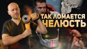 Перелом челюсти. Причины переломов нижней челюсти.