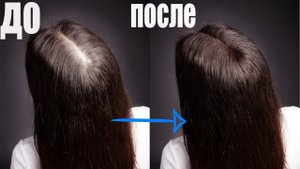 Сильнейшее средство от ВЫПАДЕНИЯ ВОЛОС _ Копеечный Ингредиент поможет Остановить ВЫПАДЕНИЕ ВОЛОС