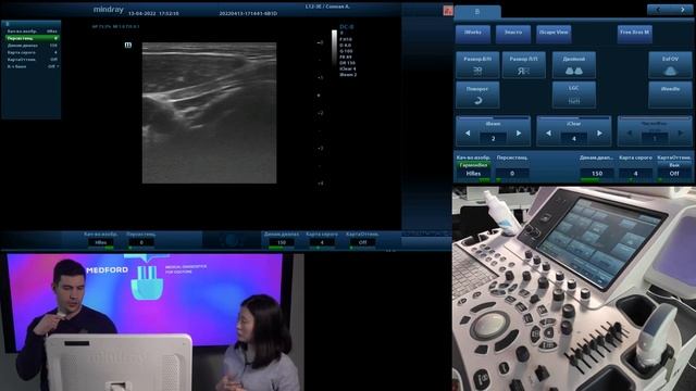 Плохая визуализация на датчике УЗИ: как диагностировать, как настраивать I Вебинар 4 смотреть онлайн