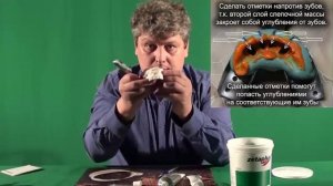 Как нужно отснять слепки с зубов