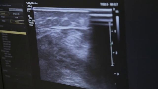 Бесплатный приём флеболога в Челябинске