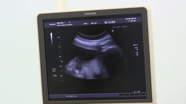 Перинатальный центр Мордовия - Специалисты о услугах центра