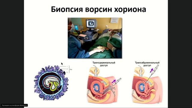 Вопросы наследования гемофилии смотреть онлайн