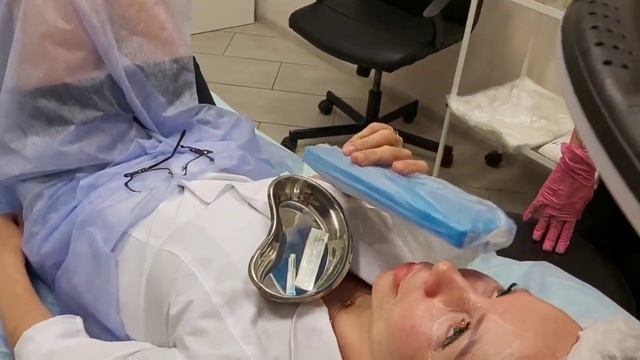 АирисКом студенты учатся: филлеры, биоревитализация. Нанесение разметки перед введением препарата. смотреть онлайн