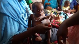 Abdul Razak is treated for malnutrition - UNICEF Burkina Faso