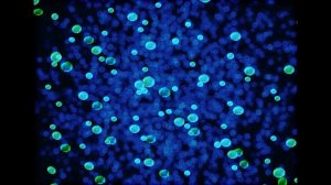 Железо всасывание, Влияние Микробиоты, Регуляция всасывания железа