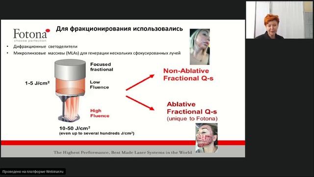 Вебинар Fotona: Цветовые маркеры старения сосудистая патология и пигментация смотреть онлайн