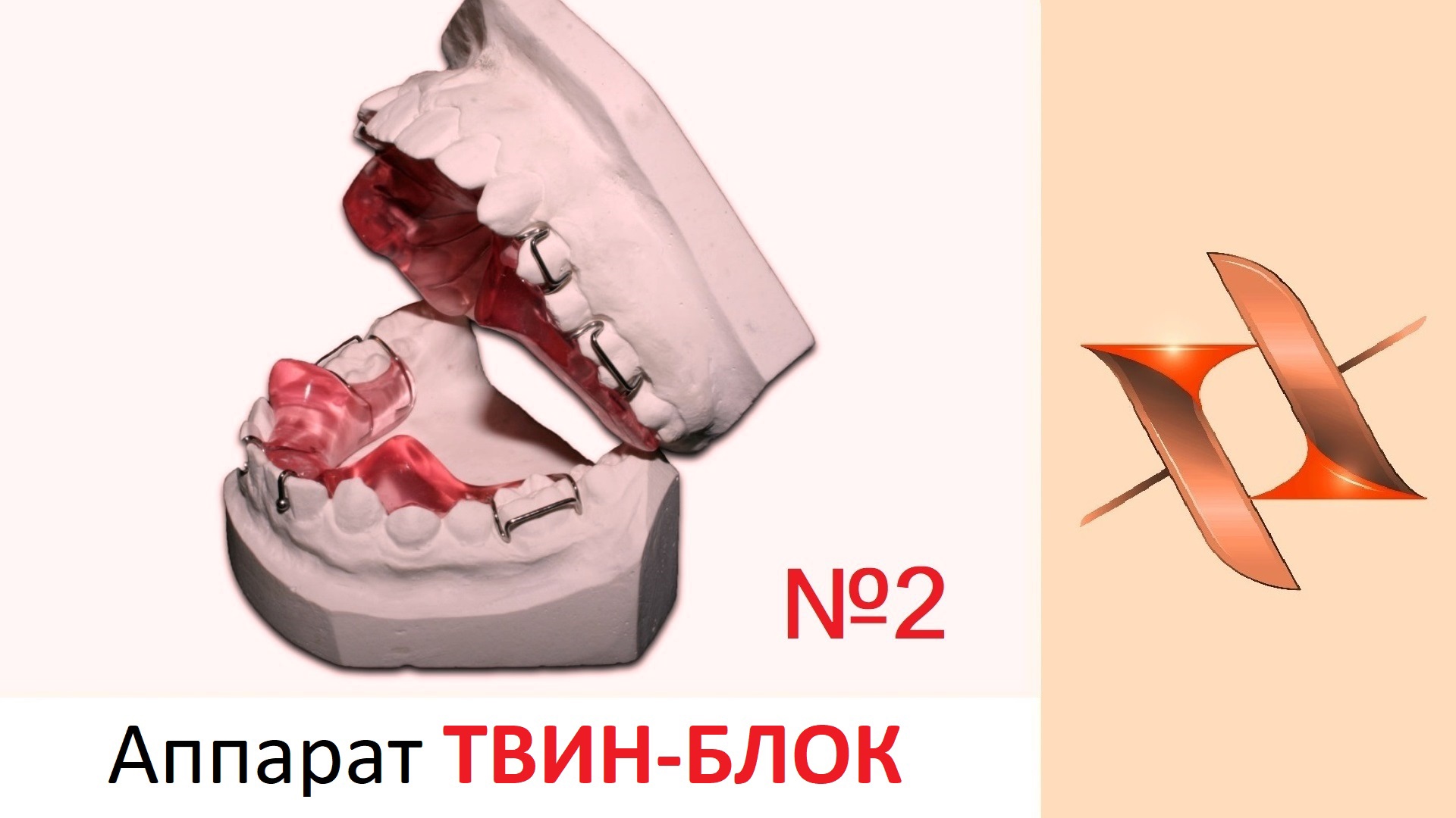 Твинблок ортодонтия картинки