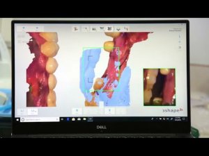 Рекомендации по сканированию полости рта с помощью 3D-сканера
