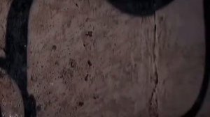 Склифосовский наслаждение и банки