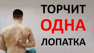 Торчит ОДНА лопатка. Комплекс упражнений ЛФК против крыловидных лопаток