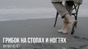 Грибок стоп и ногтей мучил 40 лет