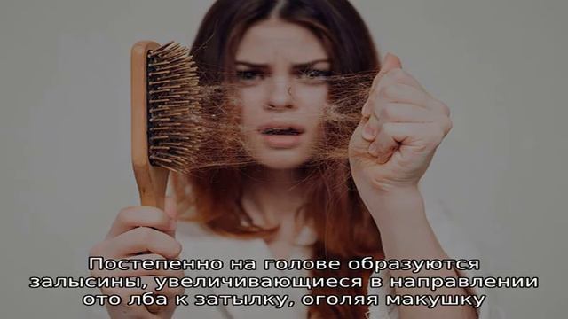 Алопеция: причины и лечение у детей