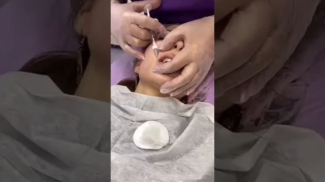 Контурная пластика губ - Салоны красоты "12 месяцев" смотреть онлайн