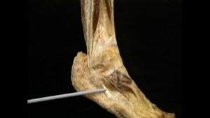 Короткая малоберцовая мышца  Musculus peroneus brevis