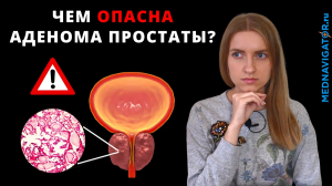 АДЕНОМА ПРОСТАТЫ - что это? Суть, причины, симптомы и диагностика ДГПЖ у мужчин| Mednavigator.ru