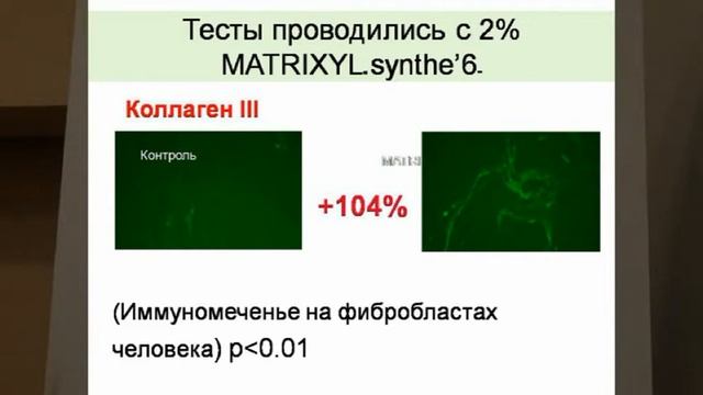Ирина Чупайленко о пептидной косметике Natria смотреть онлайн