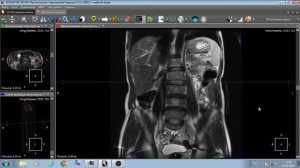 КОМПЬЮТЕРНАЯ  ТОМОГРАФИЯ - как сделать правильно