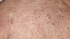 Satisfying Relaxation Skin Beauty Video With Dr. Thuy Quynh Giao Spa #01 30/05/2021