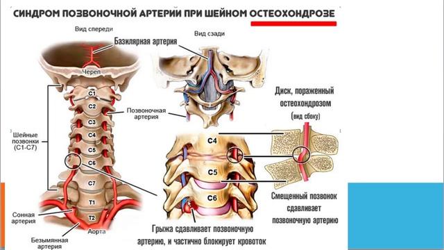 Продукт в ЕС, часть 4:  голова, шея, мозг, сосуды,  и иже с ними смотреть онлайн