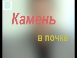 Камень в почке – что делать? Вырезать, дробить или подождать? Советы доктора Мясникова