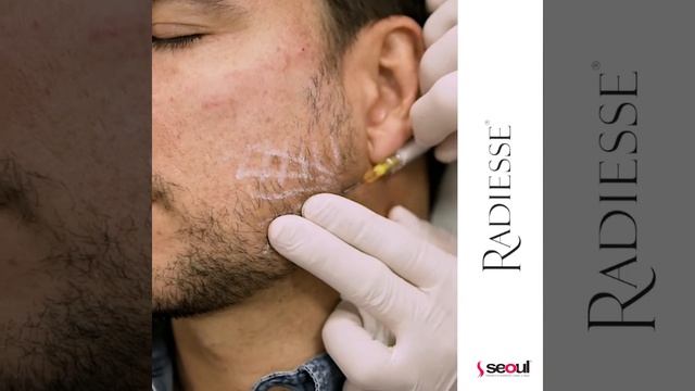 RADIESSE - Aplicación смотреть онлайн