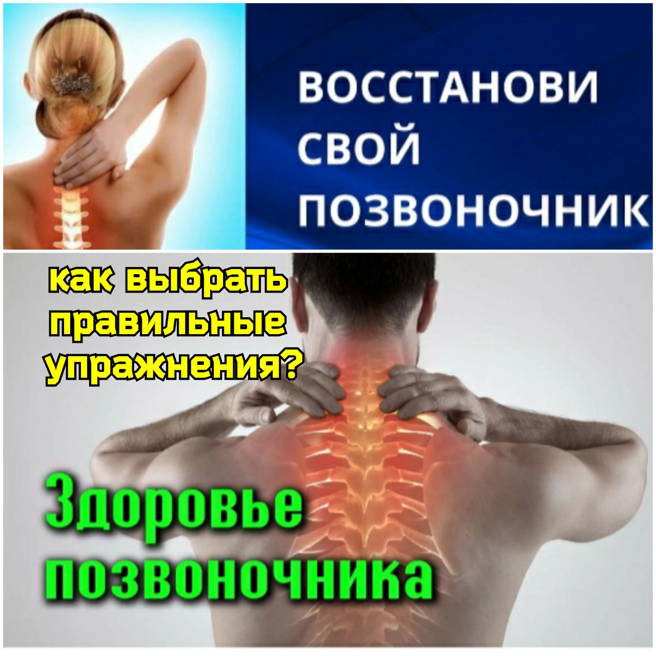 Дистрофия скелетных мышц. Нейромышечная дистрофия. Возрастная деградация мышц. Деградация мышц. Деградация мышечной ткани наследственное.