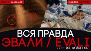 [ENG SUBS] БОЛЕЗНЬ ВЕЙПЕРОВ - ЭВАЛИ - РЕНТГЕН ЛЁГКИХ СПУСТЯ 5 ЛЕТ ПАРЕНИЯ  #эвали #evali