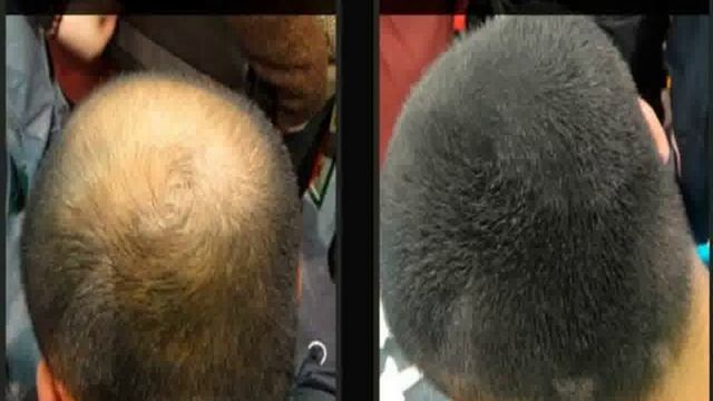 кокосовое масло для восстановления волос смотреть онлайн