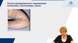 Дерматиты и токсикодермии у больных разных возрастных групп