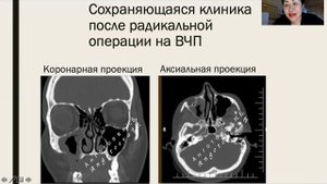 Надо ли делать контроль КТ ОНП?