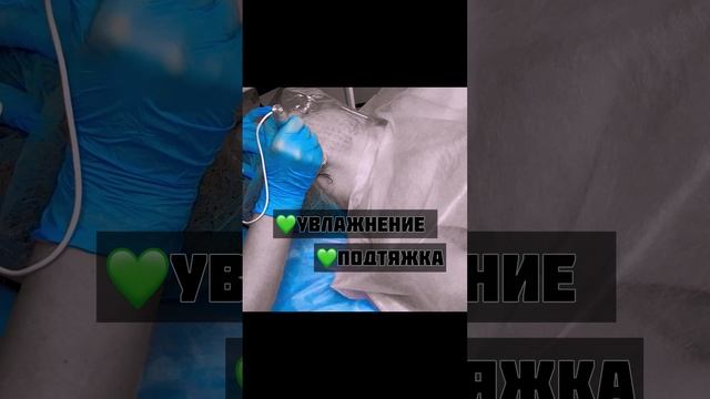 Фракционная биоревитализация