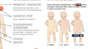 Учащихся в трех школах Сургута частично перевели на дистант из-за кори