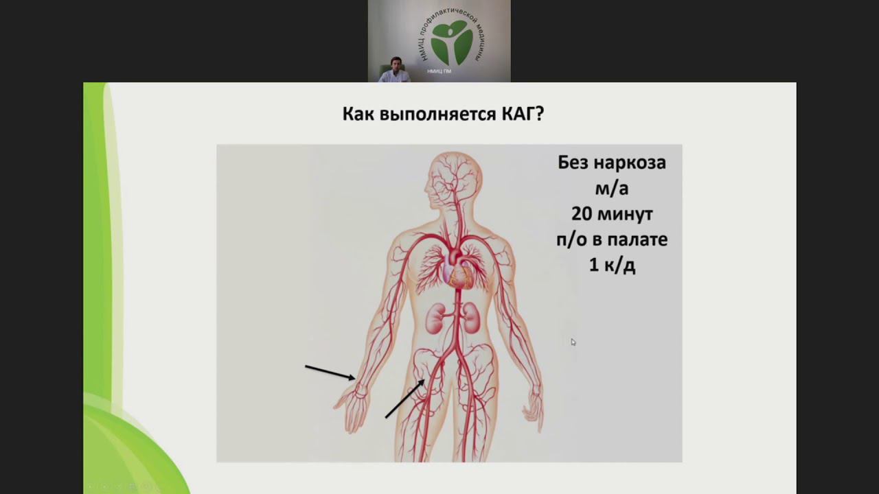 Определение показаний к проведению коронарной ангиографии в практике врача первичного звена