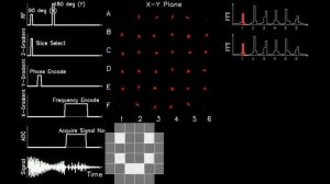 MRI: Physics and Image Creation - 2D Image Acquisition Example (Part 18/18)