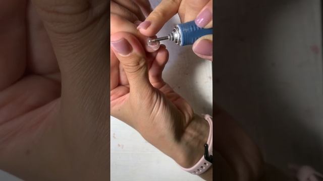 Спасаем прищемленный ноготь и обеззараживаем эм чайного дерева от Дотерра