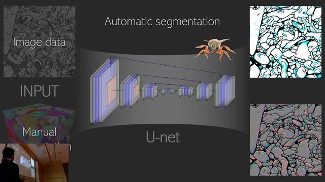 CV Forum Lund 2023 - Day4 11:00 - Valentin Gillet смотреть онлайн