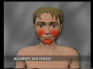 DENS therapy manual part 3