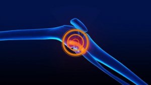 Матрица Гаряева для Всех Суставов ☀️ Универсальная Помощь для Суставов Всего Тела 1