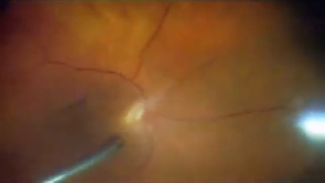 Palma e Artë për oftalmologji, Kanë 2006 смотреть онлайн