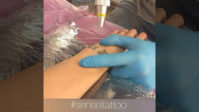 удаление некачественной татуировки лазером в Днепре смотреть онлайн