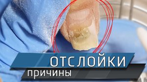 Причины отслоек пластины, почему отслаивается гель-лак.mp4