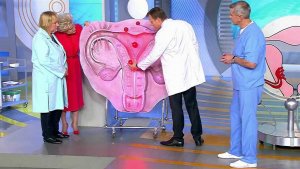 Миома матки. Доброкачественная опухоль. Жить здорово! Фрагмент выпуска от 07.10.2016