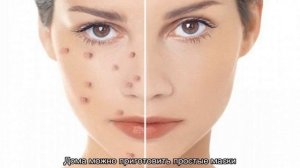 Как очистить лицо от прыщей