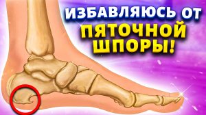 Делаю это на ночь и забыла о пяточной шпоре. Плантарный фасциит. Больные ноги превращает в здоровые.